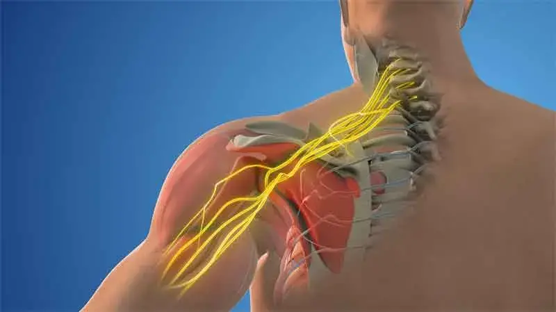 Demonstration of brachial plexus injury mechanisms and symptoms