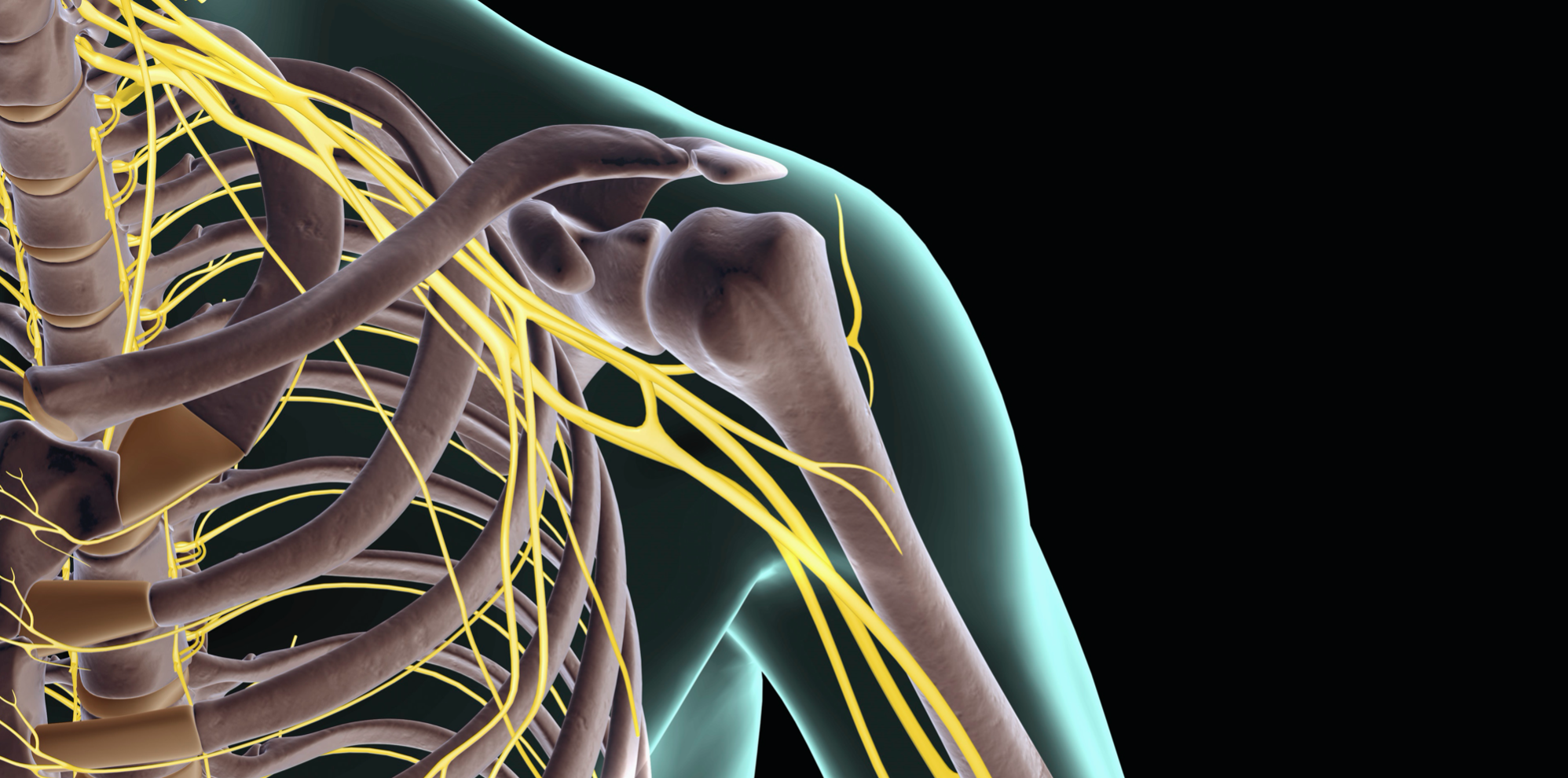 Brachial Plexus Injury