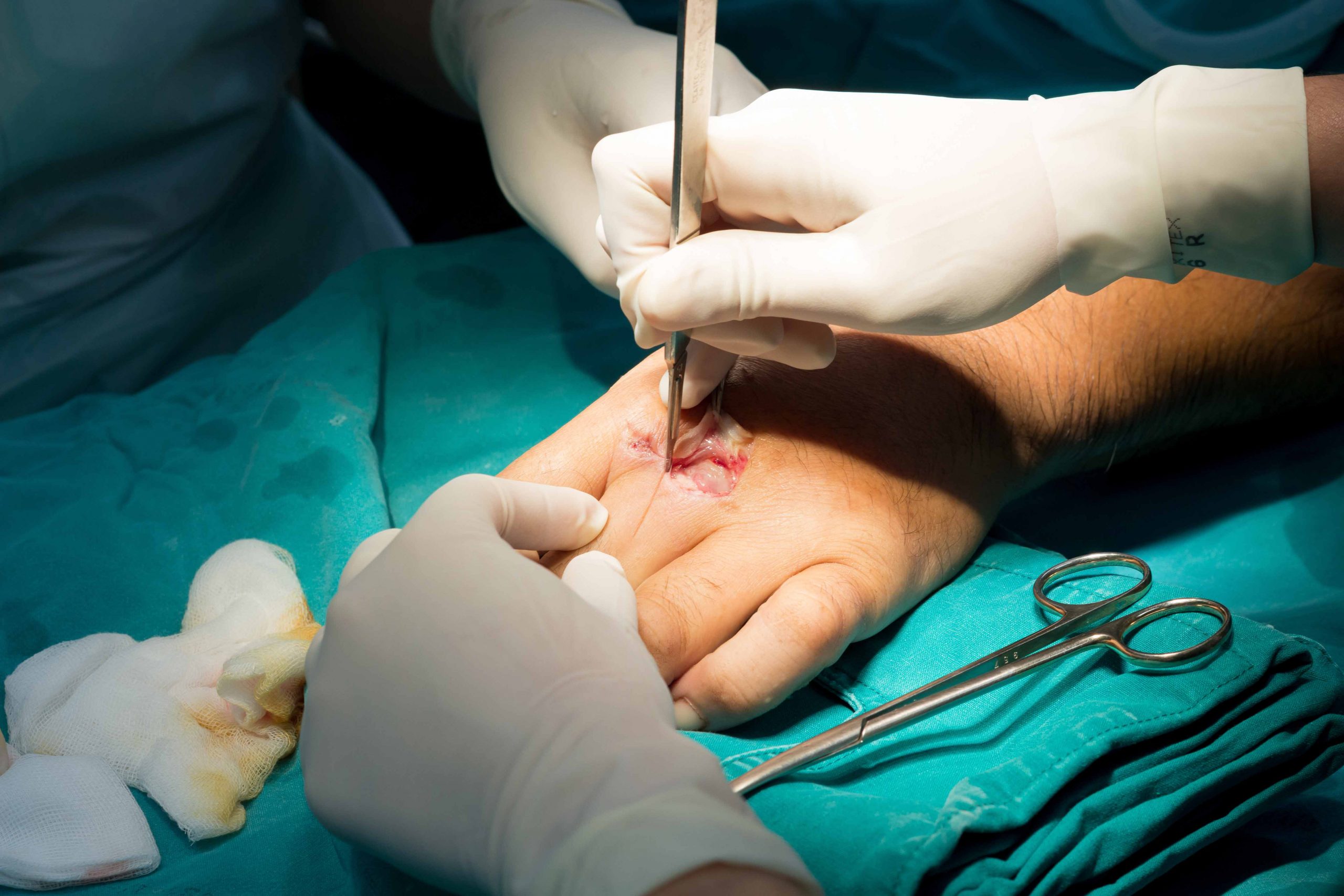 Hand Surgery Consultation